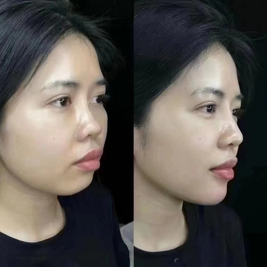 大下巴之美