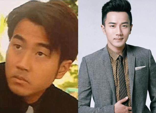 徐海星整容前后徐海星整容前后对比-第2张图片