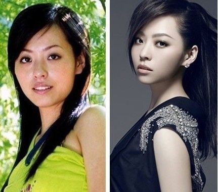 徐海星整容前后徐海星整容前后对比